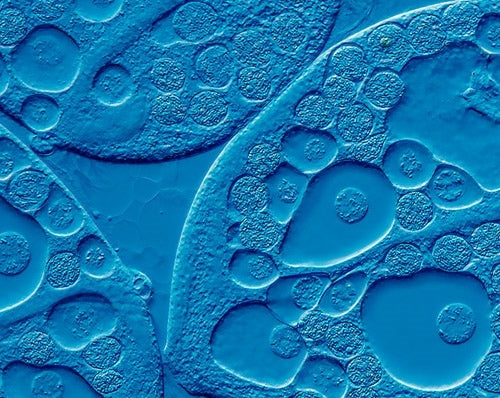 Olympus BHS DIC Nomarski Microscope